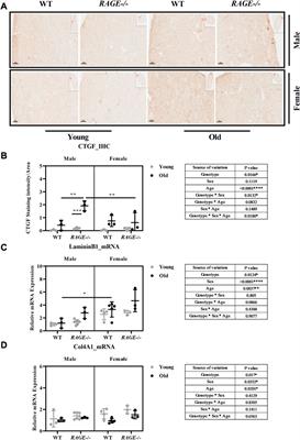 RAGE is a critical factor of sex-based differences in age-induced kidney damage